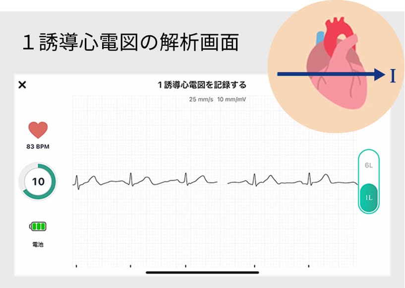 １誘導心電図の解析画面