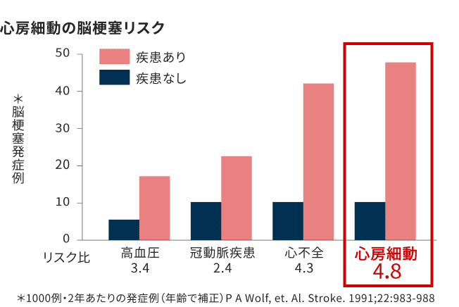 心房細動の脳梗塞リスク